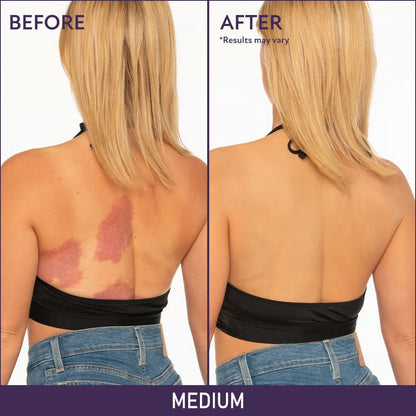 🔥🔥Hot Sale Special Price😍Soft Matte Cream Concealer