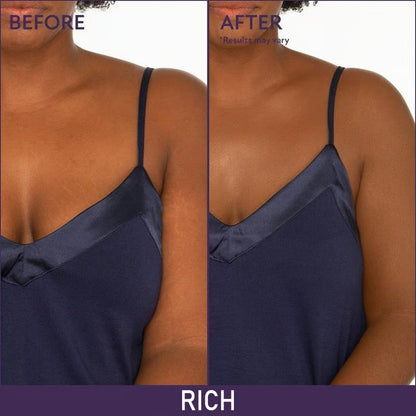 🔥🔥Hot Sale Special Price😍Soft Matte Cream Concealer