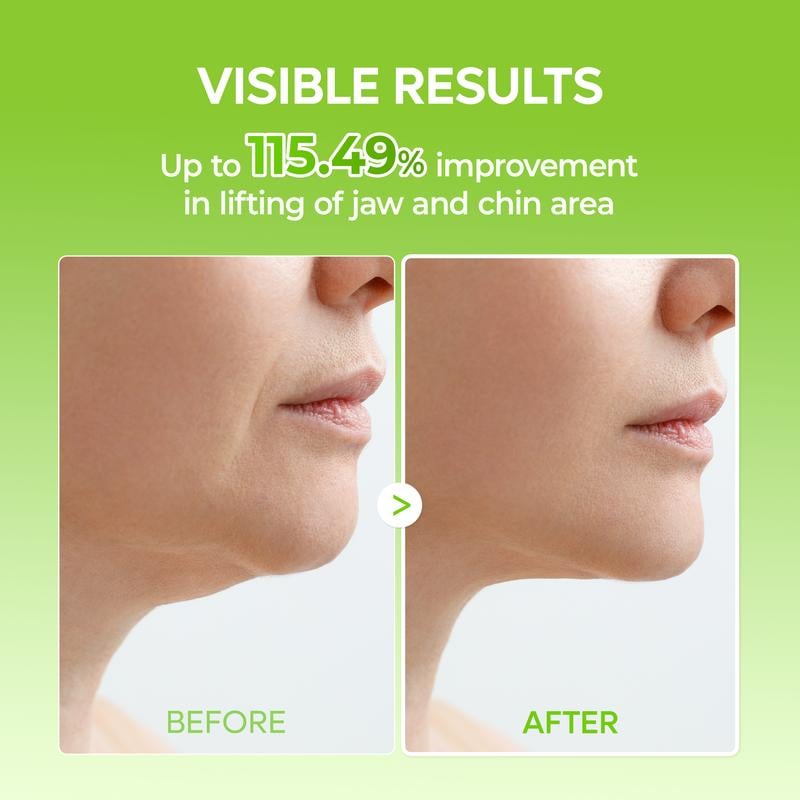 🎊BIG SALE🎊V-LIFTING MEWING BAND with Cactus Cooling Reduce Puffiness & Pore Tightening for Visible Pore Care Skin Repair
