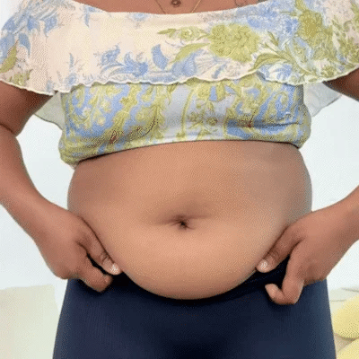 🔥 Buy 1 get 1 free🔥 - Women's Tummy Control Butt-Lifting Shapewear